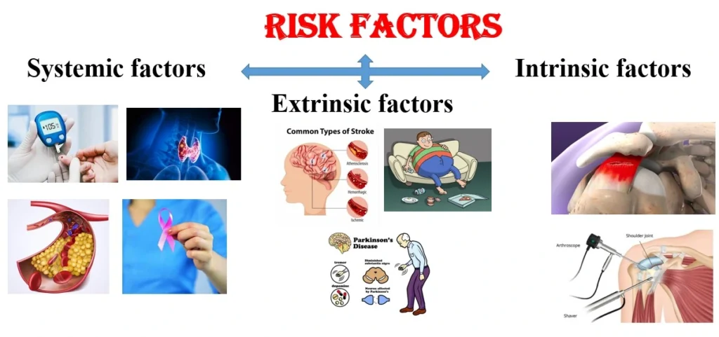 risk of frozen shoulder