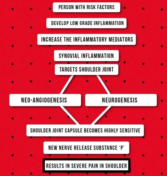 stage 1 pathophysiology of frozen shoulder