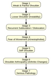 downhill journey of shoulder