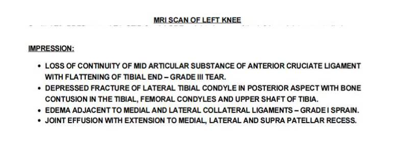 MRI Scan of left knee