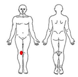 beyond surgery