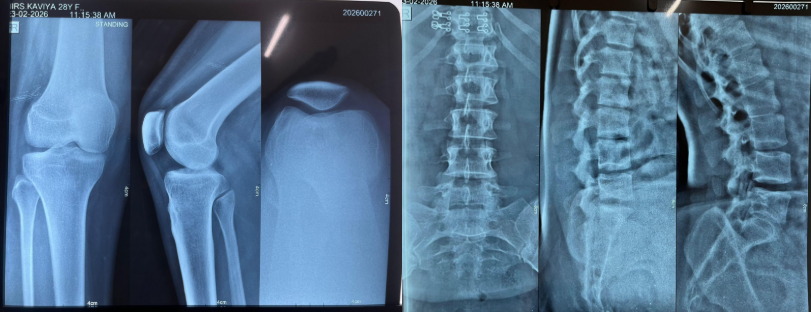 investigation xray