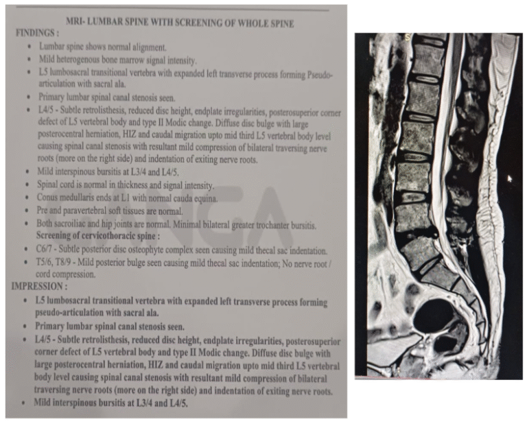 MRI-Feb-2026